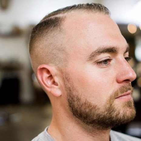 mens haircut styles balding