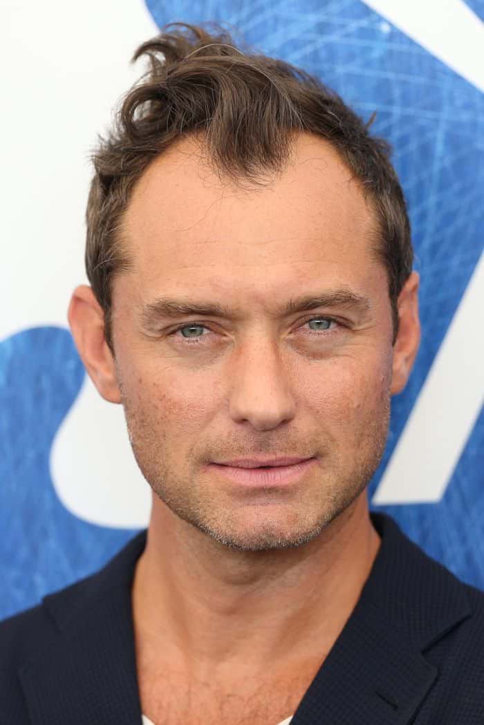 27 Haircut Styles For Balding ImmacolataAyla